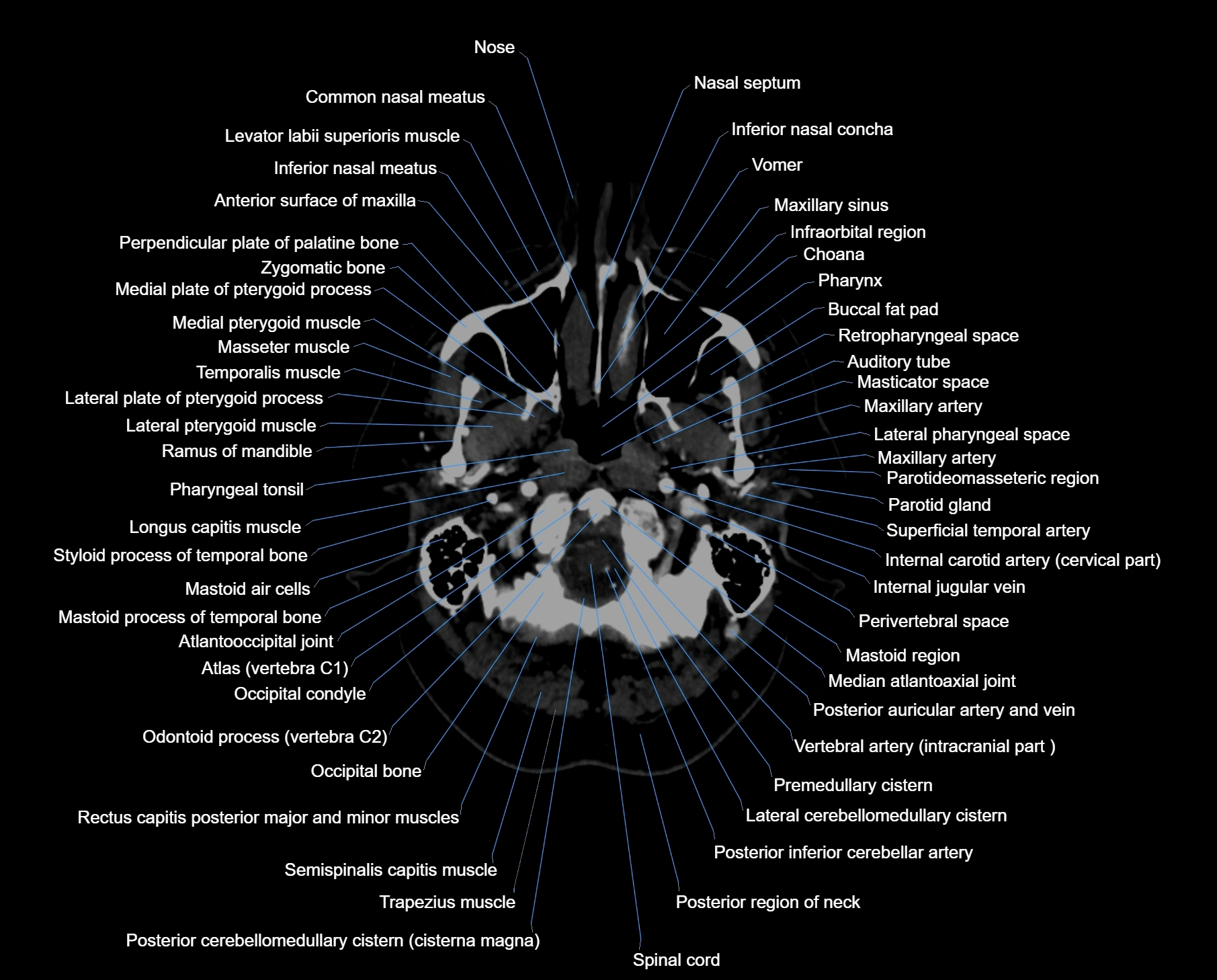 CT scan brain axial labelled cross sectional anatomy image-img-00002.webp